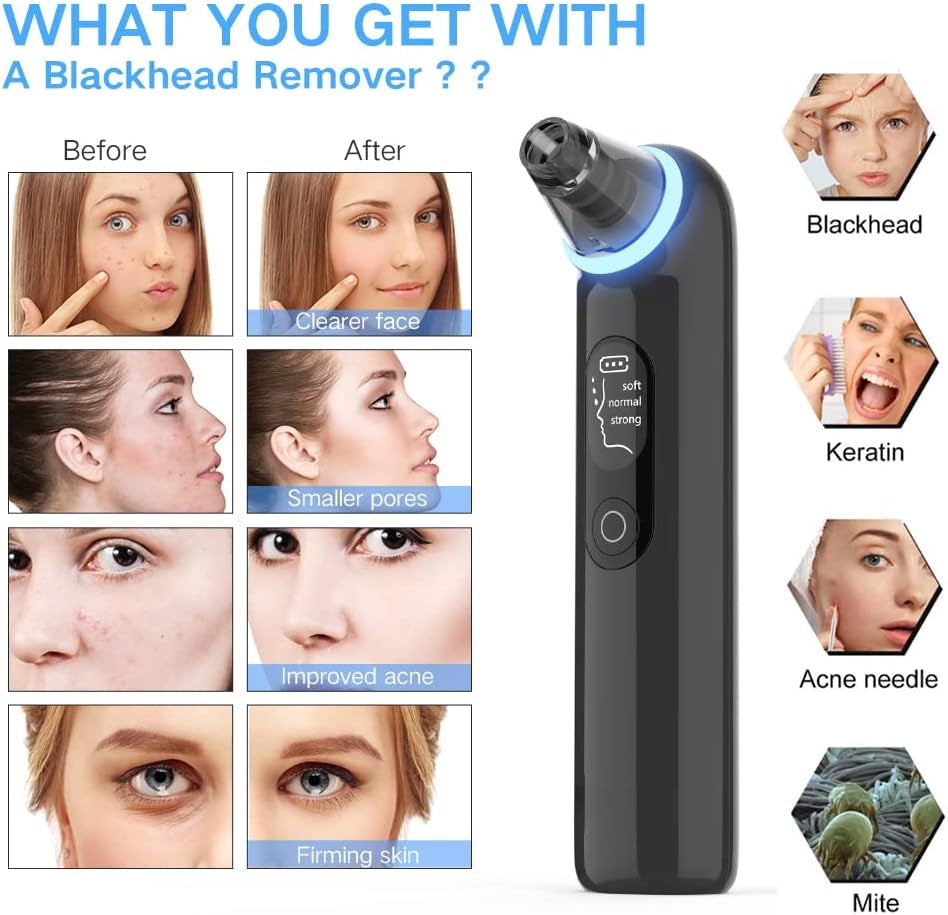 Blackhead Remover Pore Vacuum, Upgraded Pore Cleanser with Blue Light- Rechargeable Acne Extractor LED Display, Whitehead Removal, Facial Firming, Oil Reducing for Women & Men (202B-Black)